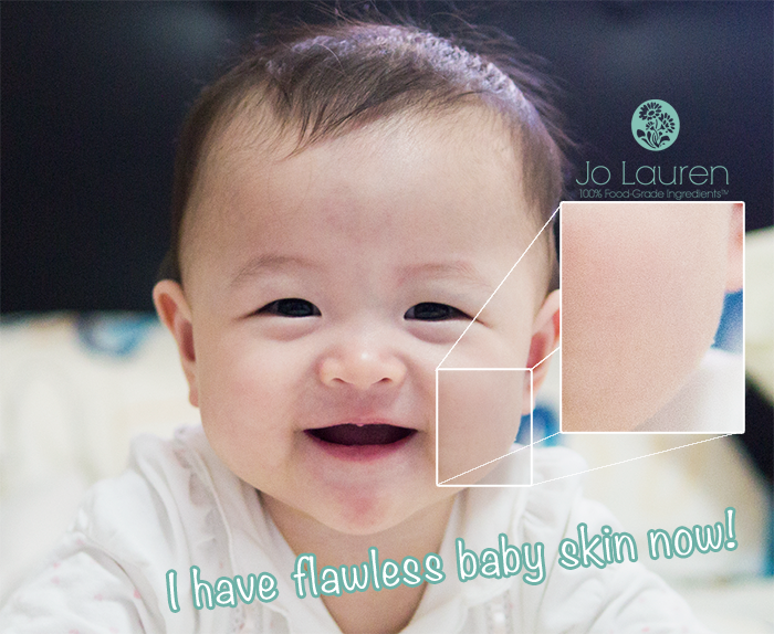 baby eczema singapore before and after